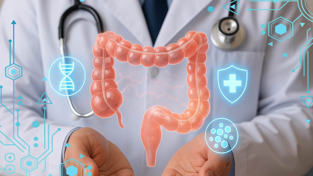 Qué causa la colitis ulcerosa con un médico mostrando un colon humano